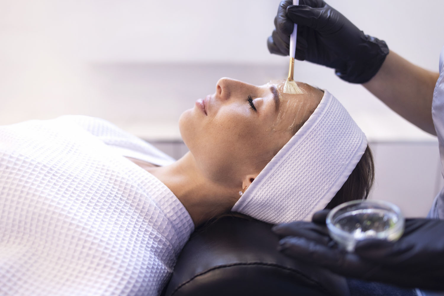 Radiant, even-toned skin after a chemical peel